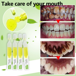 ❤️ TLOPA™ zobna pasta za odstranjevanje zobnega kamna in bakterij zobnih oblog ter različnih težav v ustni votlini.