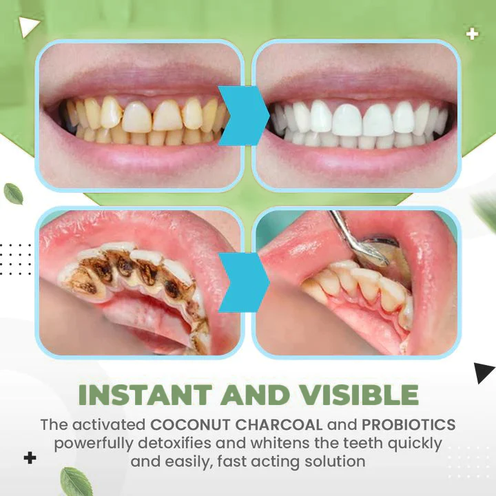 ❤️ TLOPA™ zobna pasta za odstranjevanje zobnega kamna in bakterij zobnih oblog ter različnih težav v ustni votlini.