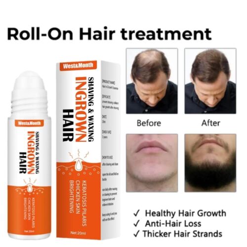 Re:act Minoxi Roll-on Hair Treatment, novi serum za rast las 2023
