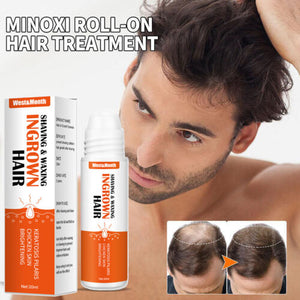Re:act Minoxi Roll-on Hair Treatment, novi serum za rast las 2023